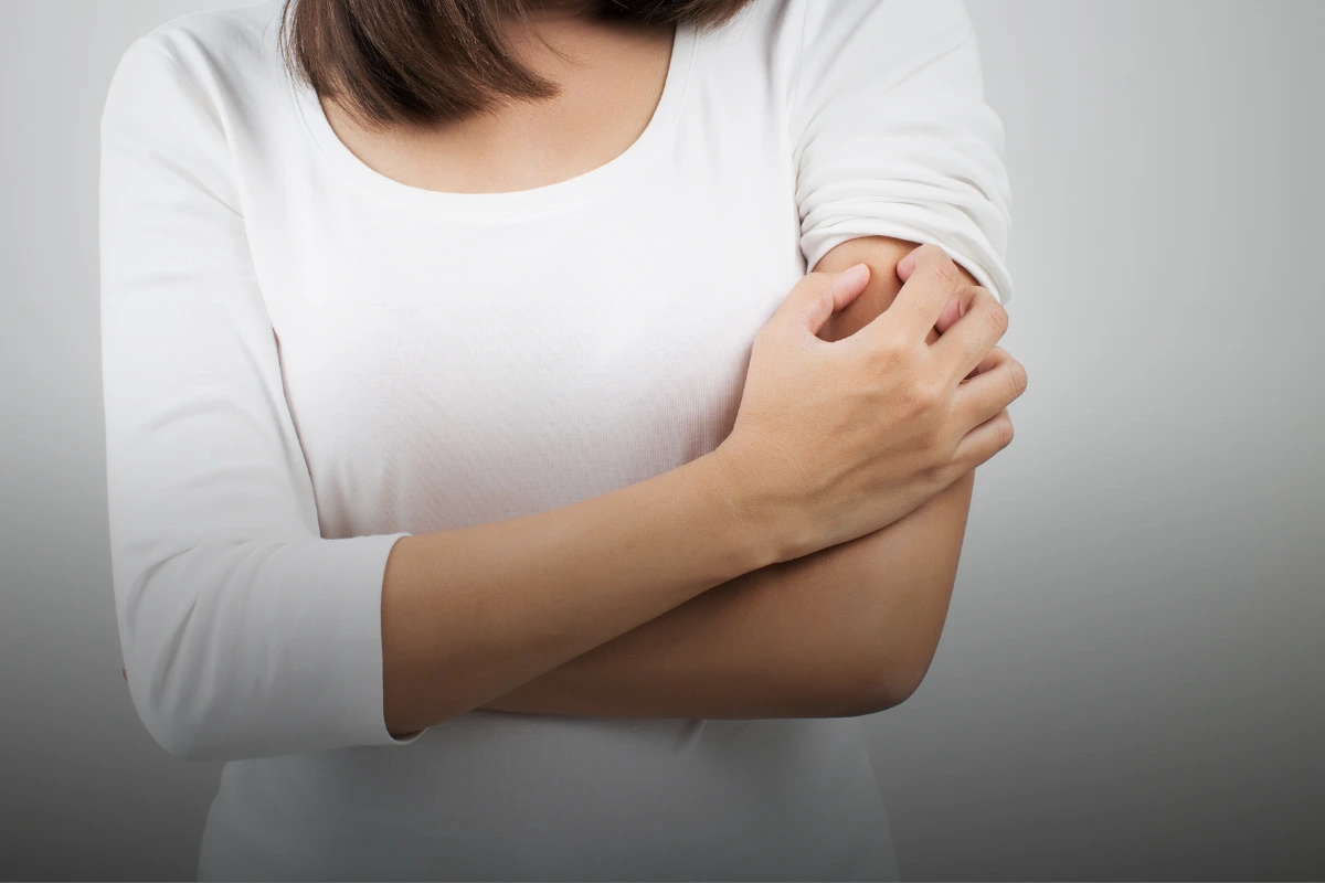 Eczema (Atopic Dermatitis) skin condition